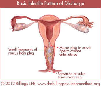 Basic Infertile Pattern of Discharge